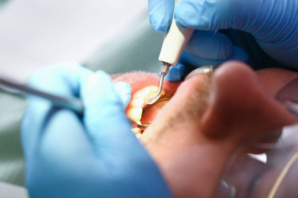 Best Emergency Dentist for Knocked-Out Tooth in Grandyle Village, NY