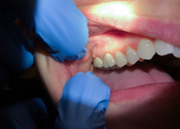 Best Pediatric Emergency Dentist in Grandyle Village, NY