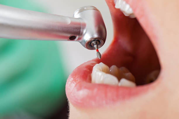 Best Emergency Dentist for Lost Fillings or Crowns in Grandyle Village, NY